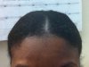Close up of hair line.JPG